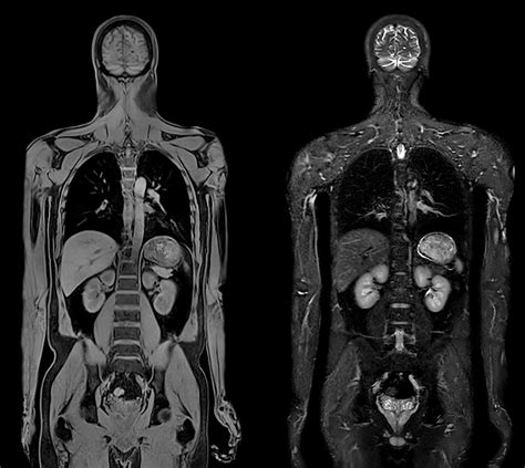 Imagine RMN a pelvisului