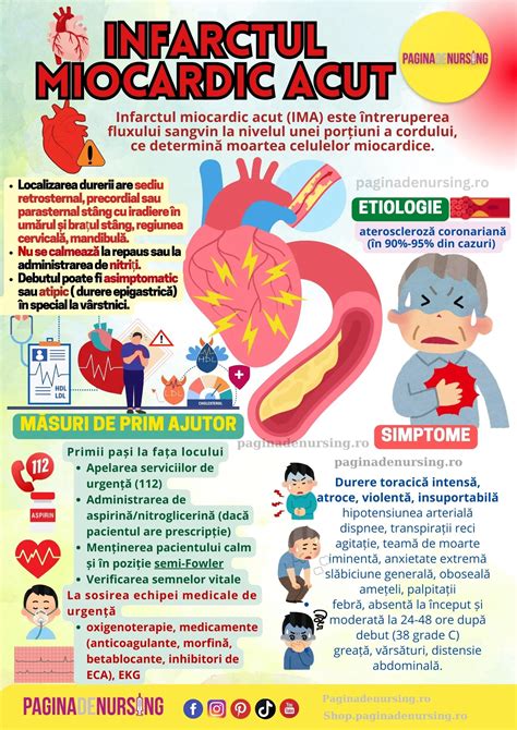 Diagramă care arată iradierea durerii în caz de infarct miocardic