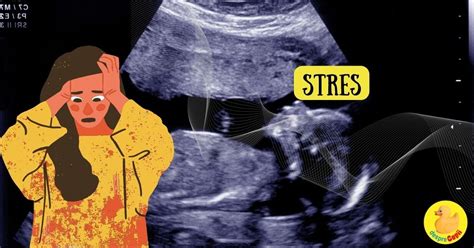 Diagrama impactului stresului prenatal asupra dezvoltării creierului