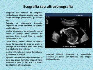 ecograf_ginecologic_exemplu