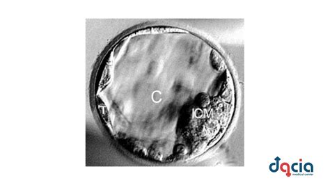 Blastocist uman de înaltă calitate