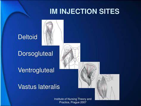 Locuri de injectare intramusculara: deltoid, vastus lateralis, ventrogluteal, dorsogluteal