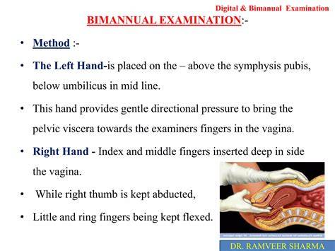 Schema vizualizării examenului ginecologic (extern, speculum, bimanual)