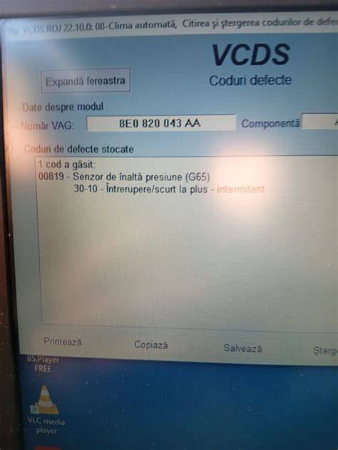 Diagnoză ecografică a corionului și plasentei