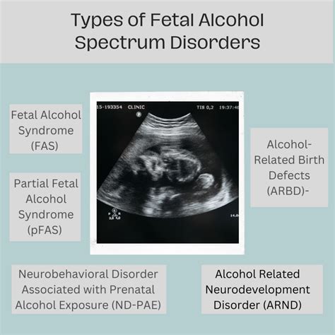 Infografic: Fetal Alcohol Spectrum și riscurile asociate