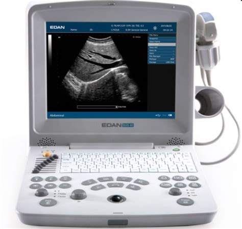 Ecran ecograf cu imaginea unui făt