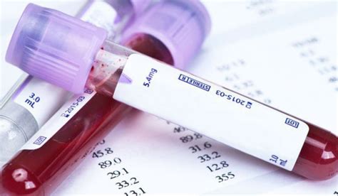 Set de analize medicale pe o masă