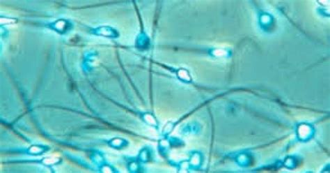 Microscop, spermatozoizi
