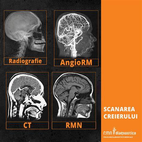 Imagine: RMN sân