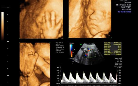 Grafic: traseul screeningului morfologic fetal pe trimestre