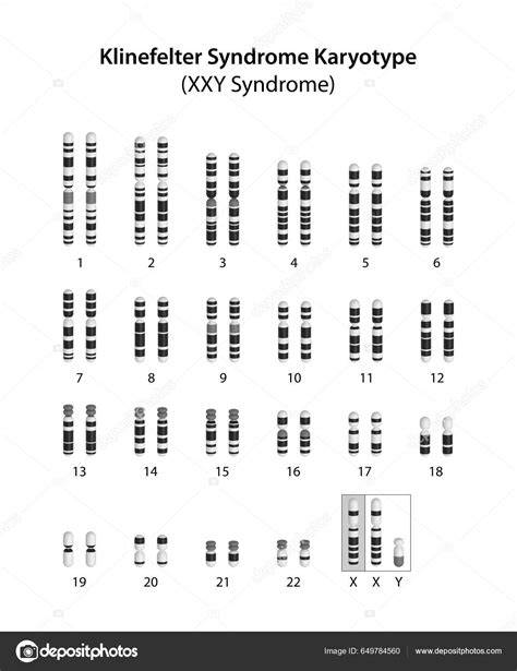 vizualizare_cariotip_Spermologie
