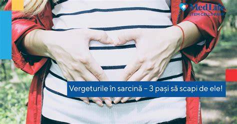 Schema explicativă: cum apare vergeturile în sarcină