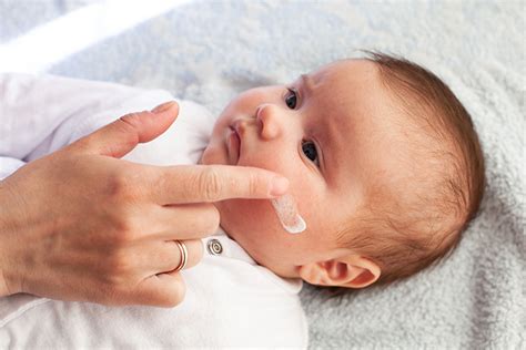 Tipuri de erupții cutanate la bebeluși