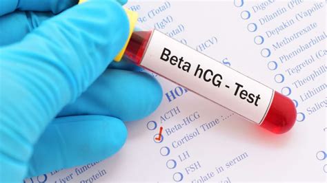 Infografic: Fluxul biologic al beta hCG în sarcină și în afecțiuni trofoblastice