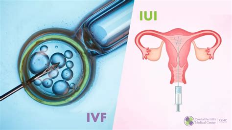 Infografic: cum funcționează IUI, IVF și ITI