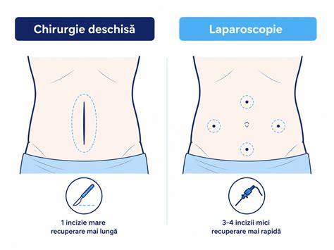 Infografic: comparativ chirurgie deschisă vs. laparoscopică în obstetrică veterinară