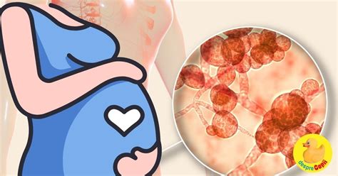 grafice despre rata infectiilor cu Candida in sarcina