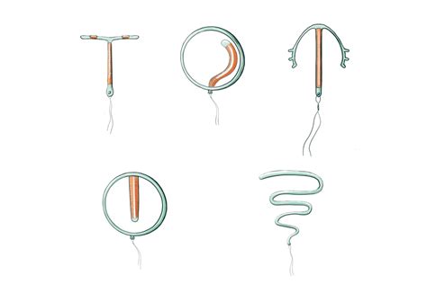 Diagramă cu tipuri de sterilet