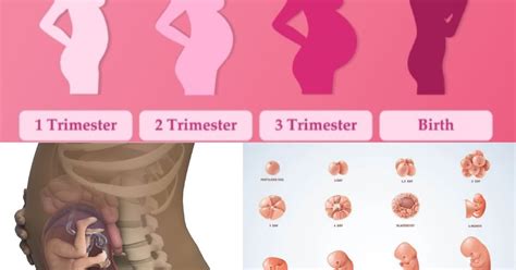 infografic cu comparație naștere naturală vs cezariană