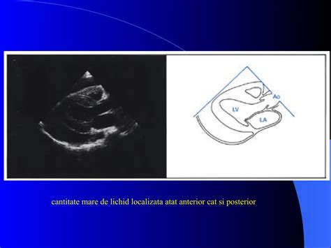 Diagrama ecocardiografiei cardiace