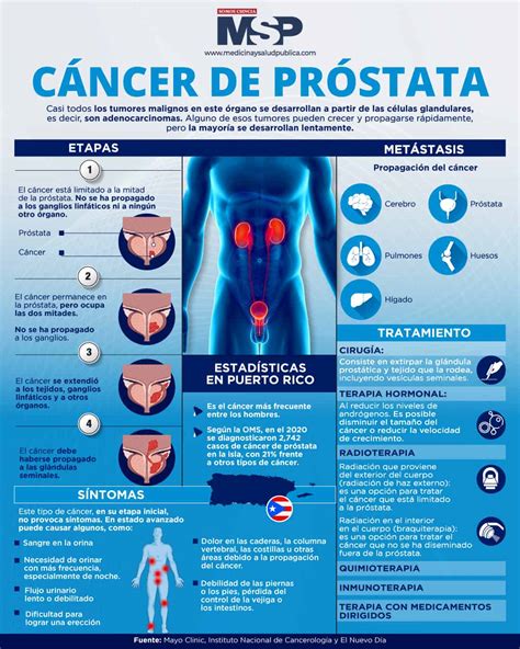 prostata_testicular_cancer_ro.jpg