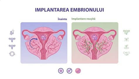 Ilustratie explicativa: cum se produce implantarea embrionului în mucoasa uterina