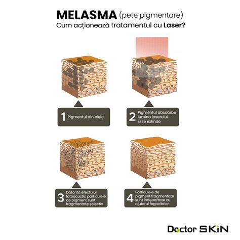 Infografic: Sistemul melanocitar și procesul de pigmentare al părului
