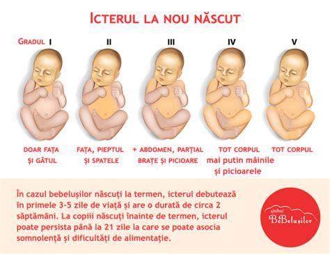 Nou-născut cu icter
