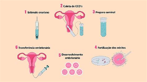 Diagrama etapelor FIV