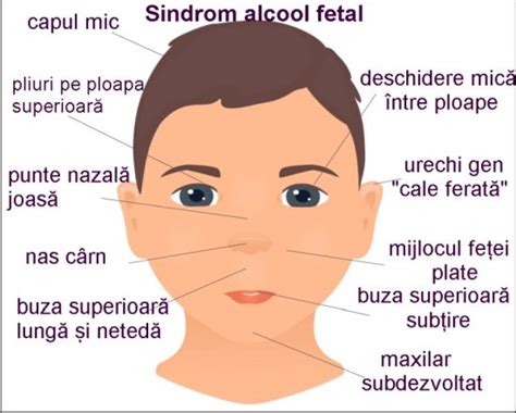 Infografic: Manifestări ale sindromului alcoolic fetal (SAF) și stadii ale embriogenezzei