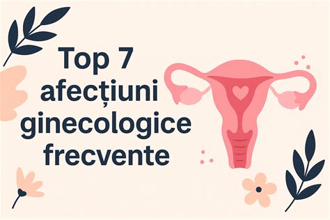 Infografic cu cele mai comune afecțiuni ginecologice