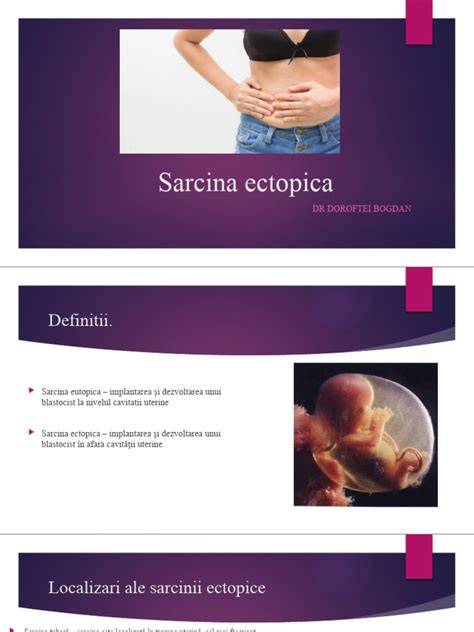 Grafic: pașii principali în diagnosticarea sarcinii ectopice