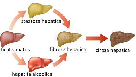 Schema de actiune a Ursofalk in ficat si bila