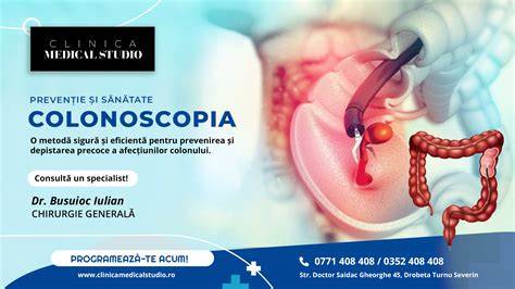 Infografic: Configuratia generala a colonului si localizarea unghiului colic stâng