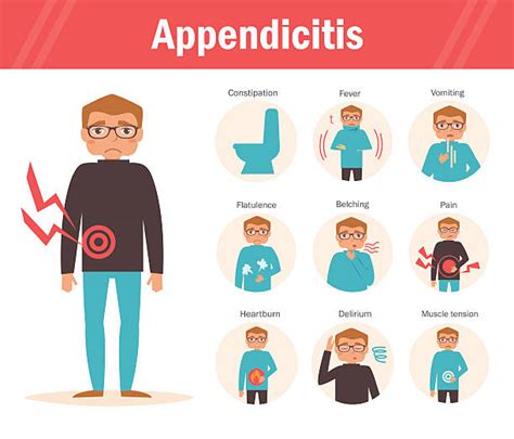 Ilustrație a apendicitei