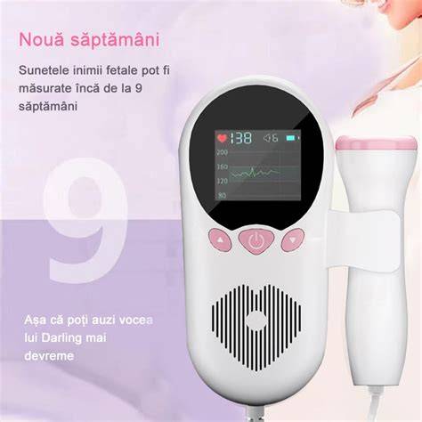 Grafice: monitorizarea ritmului cardiac fetal în travaliu