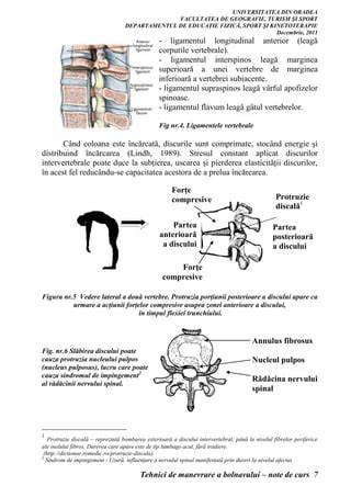 Diagrama discurilor intervertebrale si procesul de herniere a nucleului pulpos