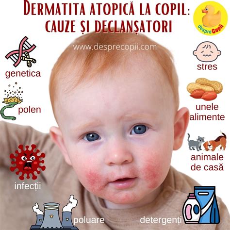 Ilustratie cu zonele corpului afectate de dermatita atopica la bebelusi