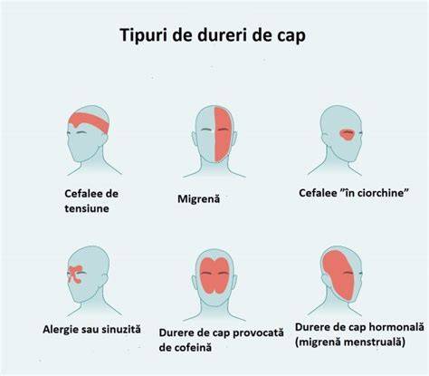 Tips pentru prevenția durerilor de cap în sarcină: hidratare, odihnă, posture, exerciții ușoare