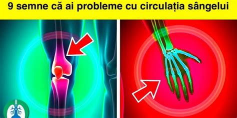 Infografic: Căi de flux ale sângelui în vene - superficială vs profundă
