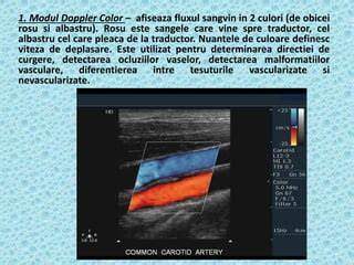 Diagramă Doppler - flux sangvin în sarcină