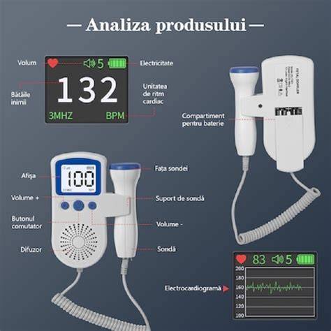 Fluxuri Doppler la nivel fetal - exemplu de monitorizare