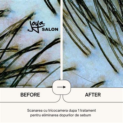 Diagramă: Comparație între diferite tratamente pentru scalp