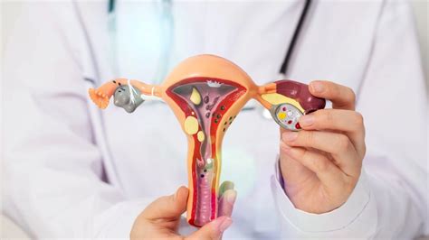 Infografic despre opțiunile de tratament pentru chisturile ovariene