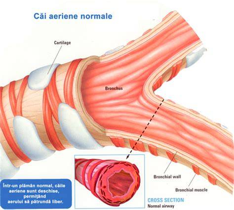 Infographic: Căi aeriene normale vs. cele îngustate la copii