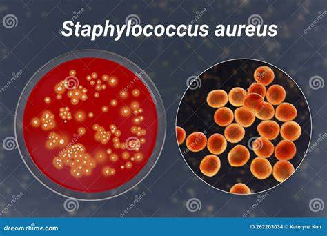 Schema interactiilor Staphylococcus aureus si produse toxice