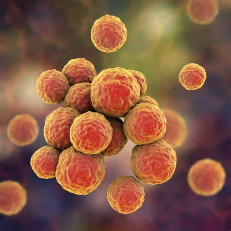 Diagramă: MRSA vs. stafilococ standard - diferențe în tratament