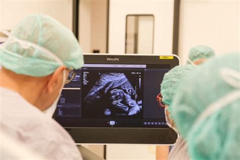 Ecografie 3D a unui făt în uter