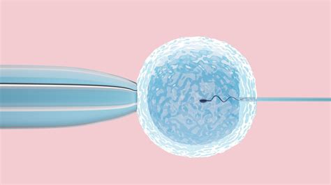 Diagrame: proceduri FIV (Inseminare artificială, FIV, ICSI, vitrificare)
