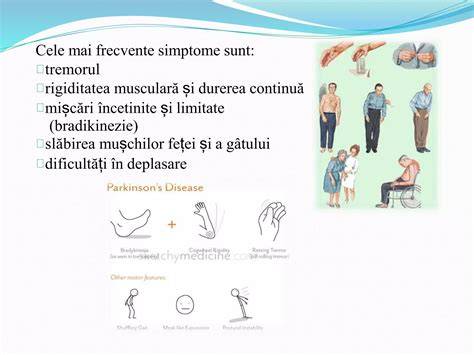 Infografic despre mecanismele sforitului în sarcină: relaxarea mușchilor gâtului, congestia nazală și efectele asupra fluxului aerian